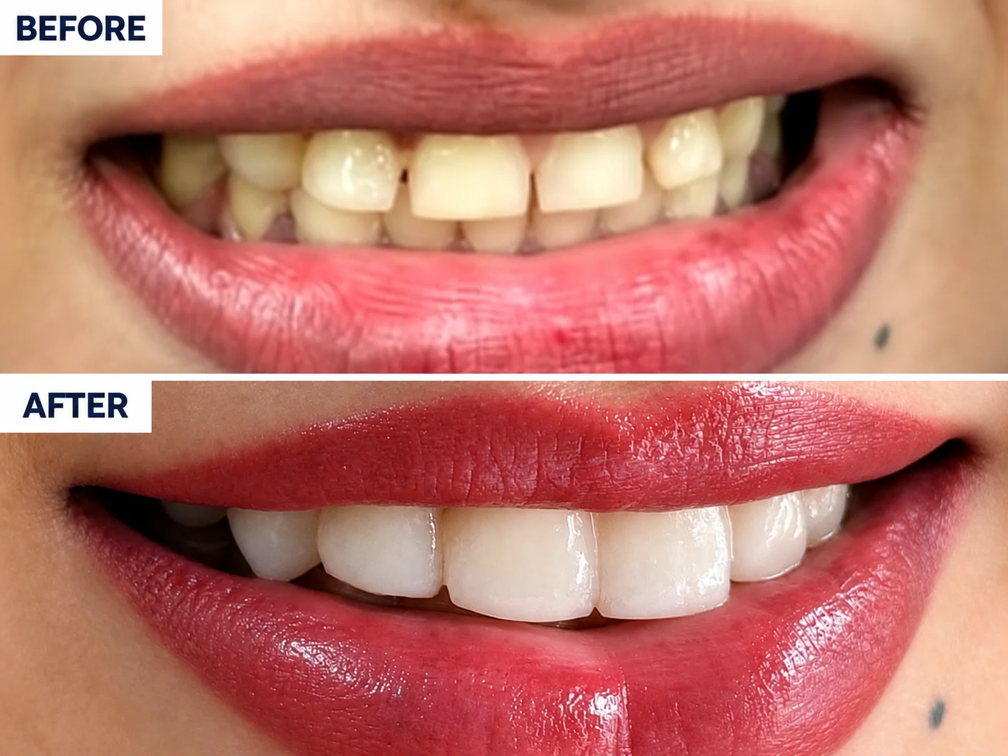 Aesthetic Dentistry
